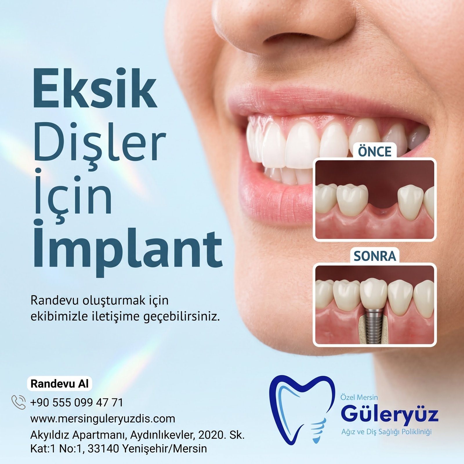 İmplant Tedavisi Sonucu Oluşabilecek Komplikasyonlar: